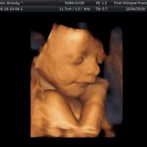 Meet your Posher, Brandy